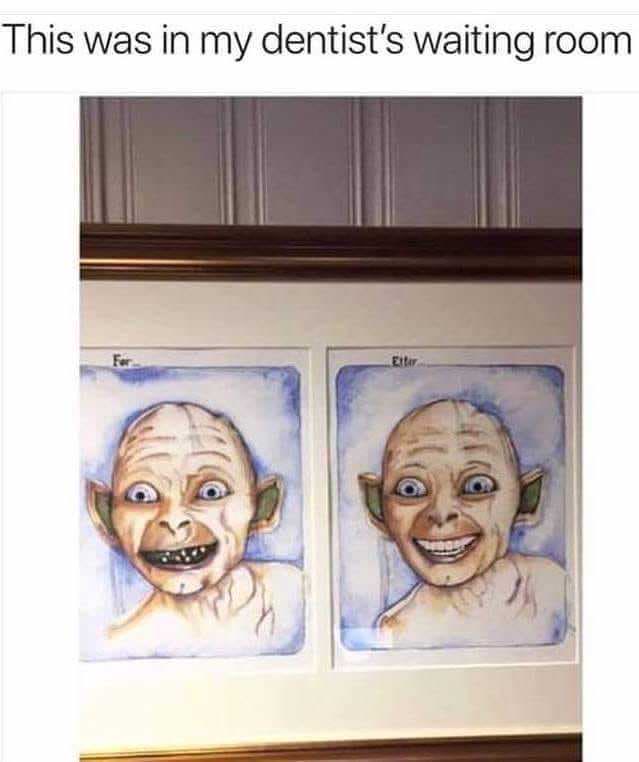 Chaotic Meh meme titled “This Was in My Dentist’s Waiting Room – Gollum Before and After.”